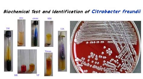citrobacter freundii biochemical test results